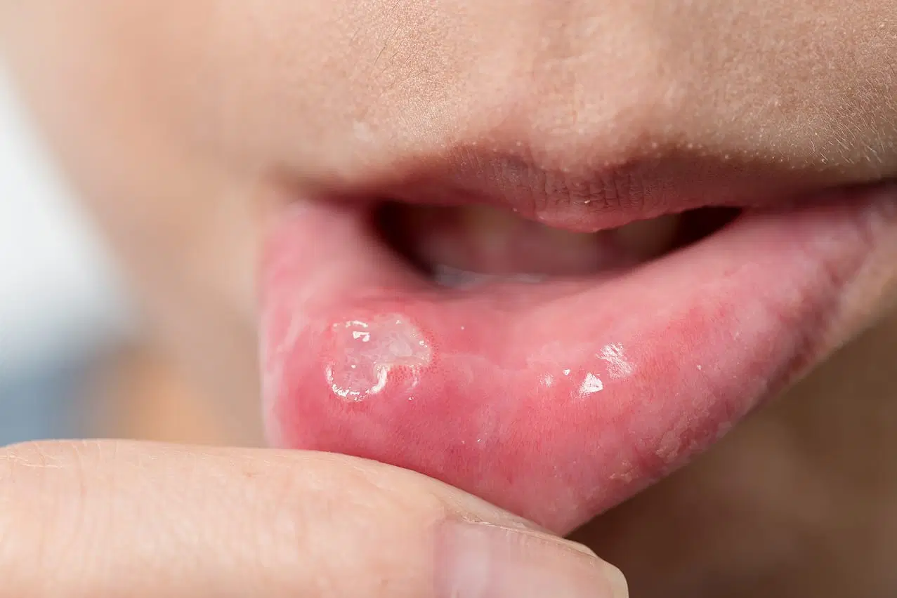 Oral Pathology